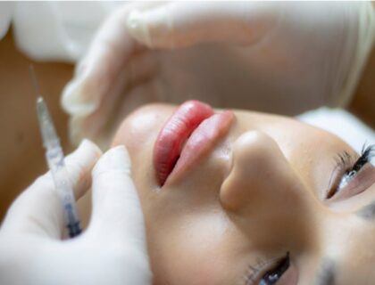 Dermal Fillers